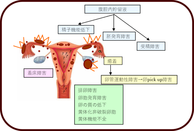 不妊症と子宮内膜症 子宮内膜症があっても妊娠できる 桃クリブログ 大阪の不妊治療なら 園田桃代artクリニック