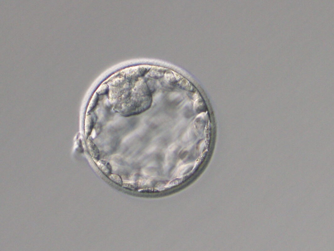 胚盤胞の画像